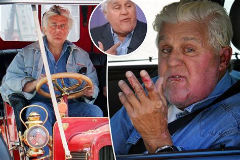 who is jay leno's agent|jay leno accident.